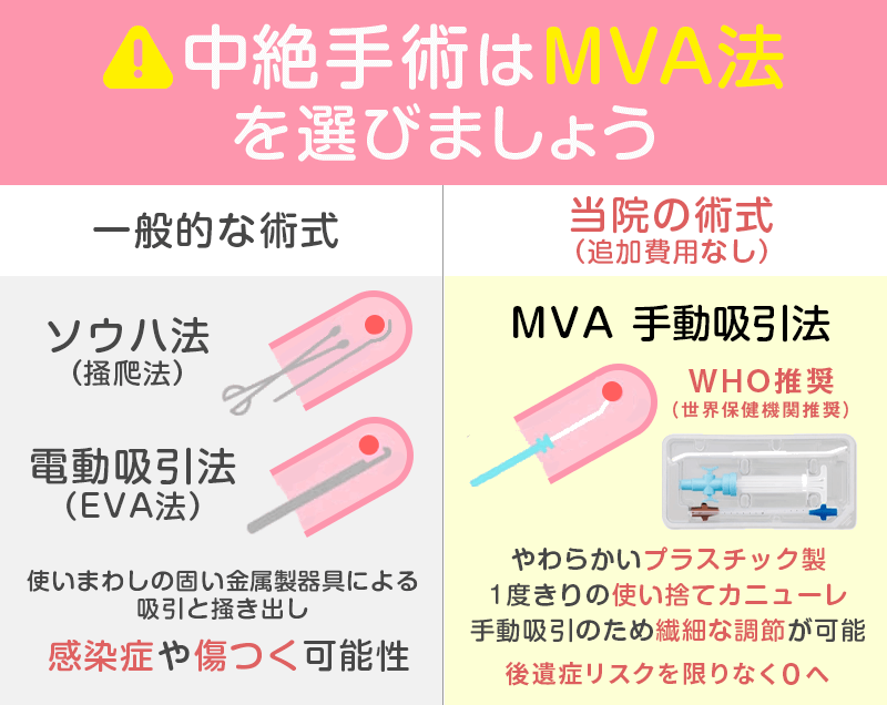 中絶手術の術式｜ソウハ法・EVA・MVAの違い