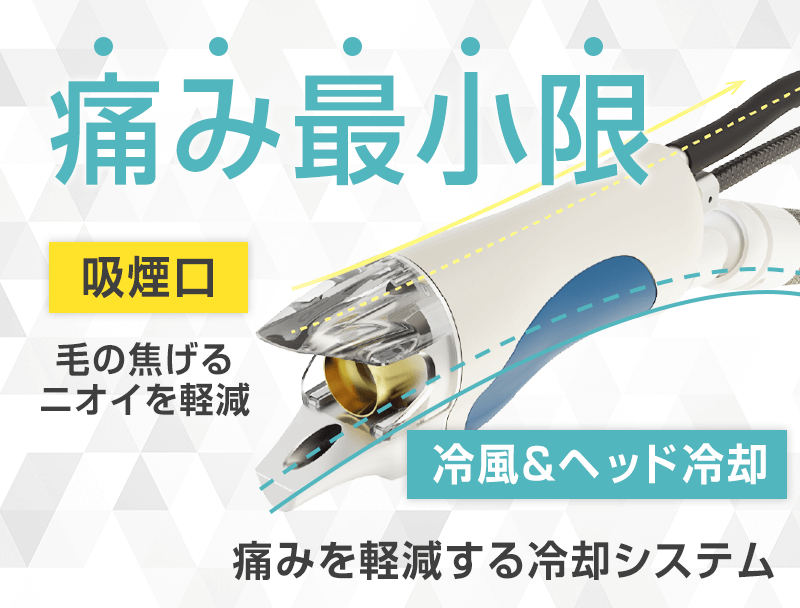 独自の冷却システムで医療脱毛の痛み軽減