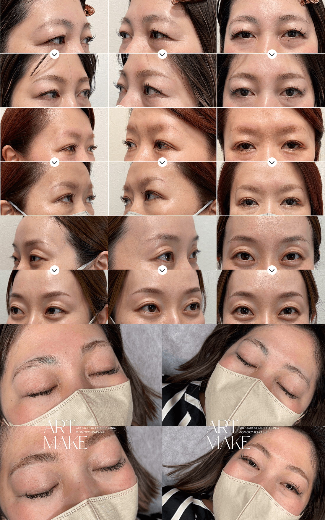 医療アートメイク症例