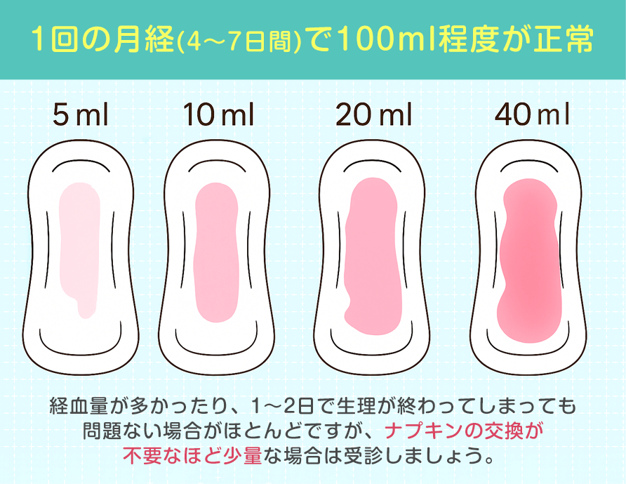 正常な経血量と過少月経の目安