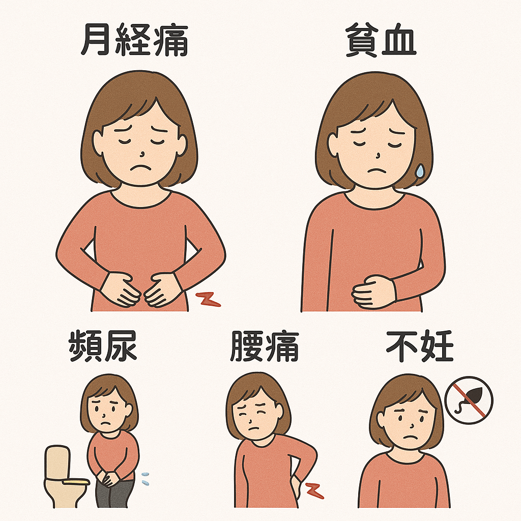 子宮筋腫の主な症状