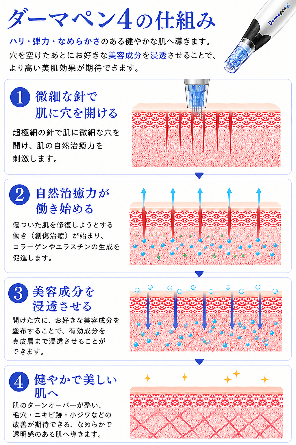 ダーマペン4の仕組み