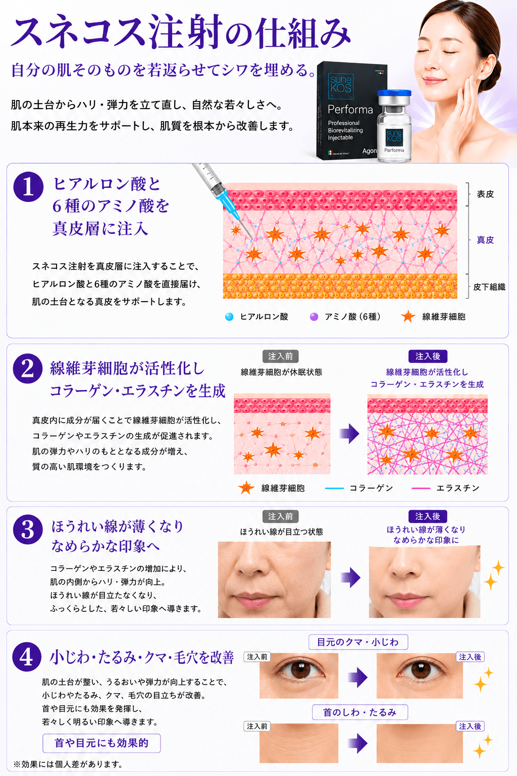 スネコス注射のしくみ