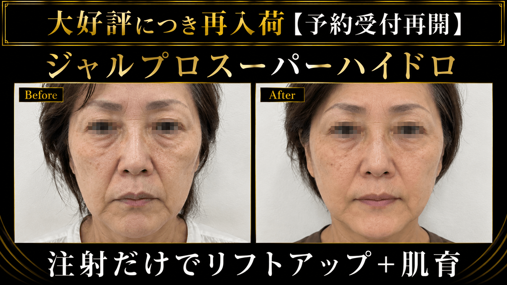 ジャルプロスーパーハイドロ